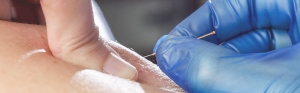 Dry Needling – Ξηρός Βελονισμός